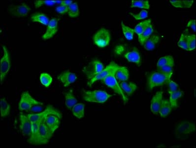 Polyclonal Rabbit anti-Human RAB40AL Antibody (IF)