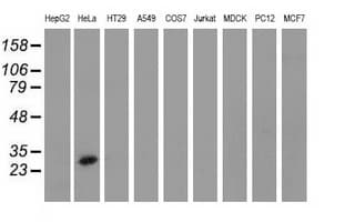 GSTT2 Antibody (clone OTI4F9)