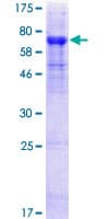Human HHLA2 Protein (Recombinant GST)