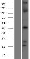 TBX1 Protein (Over-Expression Lysate Myc-DDK (Flag))