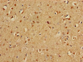 PSMA3 Antibody