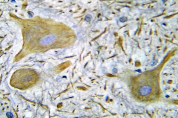 GRIN1 / NMDAR1 Antibody (Ser902)
