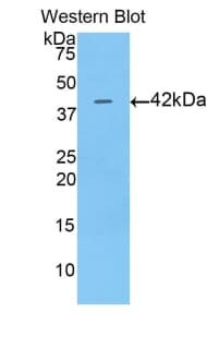 Alpha-Fetoprotein Antibody (aa263-386, Cy3)