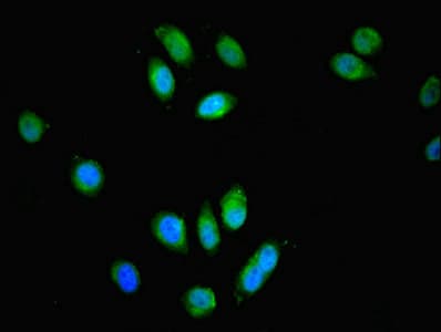 SPG21 / MAST Antibody