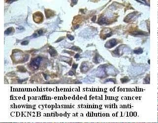 CDKN2B / p15 INK4b Antibody