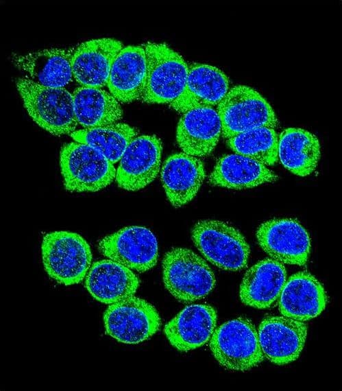 ANKRD34B Antibody (aa467-495)