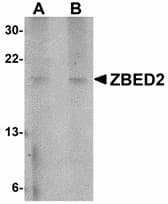 IHC-plus™ Polyclonal Rabbit anti-Human ZBED2 Antibody (IHC, WB)