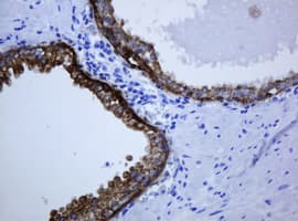 KRT5 / CK5 / Cytokeratin 5 Antibody (clone OTI4A7)