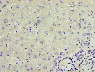 TRPM2 Antibody (aa60-119)