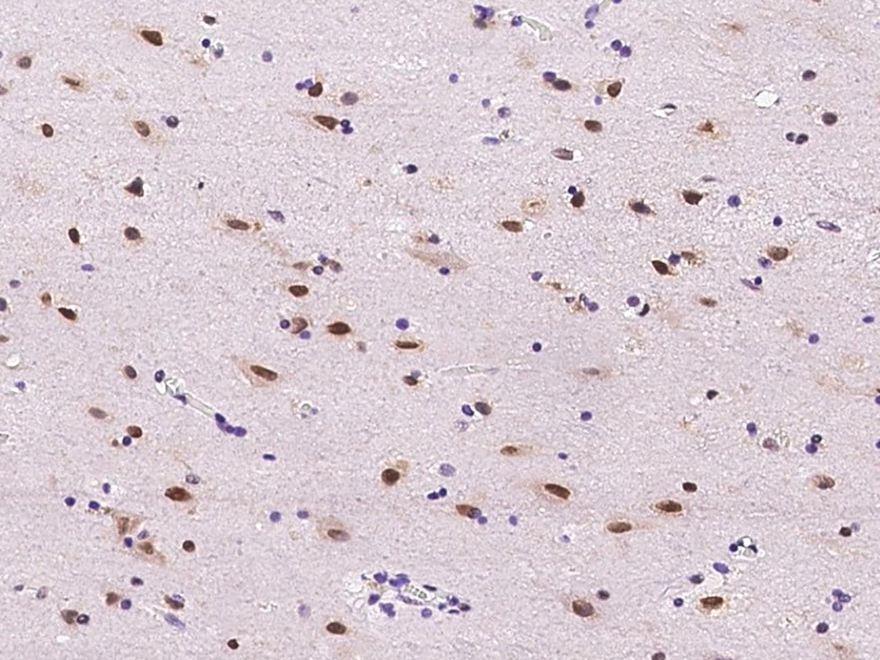 E2F6 Antibody