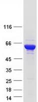 Human NARS Protein (Recombinant Myc-DDK (Flag))