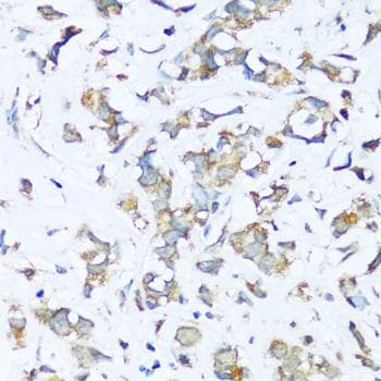 Polyclonal Rabbit anti-Human ATP5I Antibody (IHC, IF)