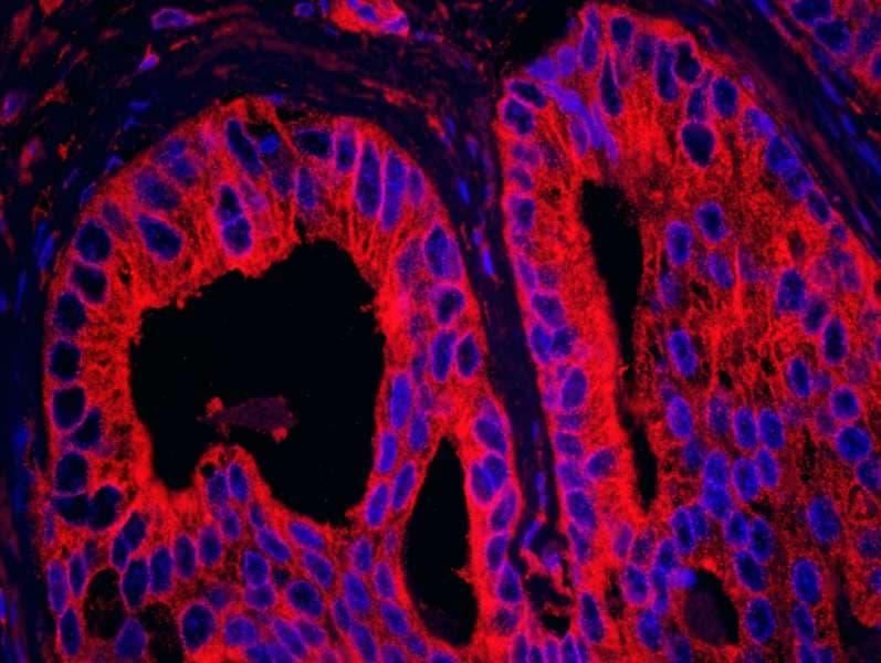 Polyclonal Rabbit anti-Human MAPRE1 / EB1 Antibody (aa245-268, IHC, IF)