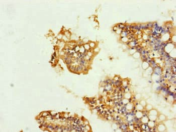 UQCRC1 Antibody