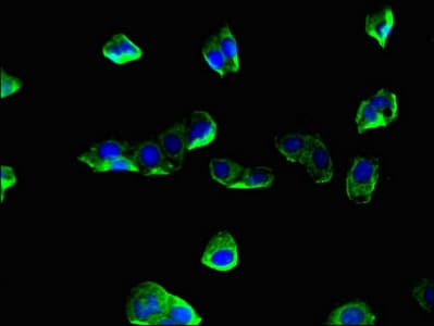 CORO1A / Coronin 1a Antibody