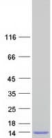 Human SCGB1C2 Protein (Recombinant Myc-DDK (Flag))