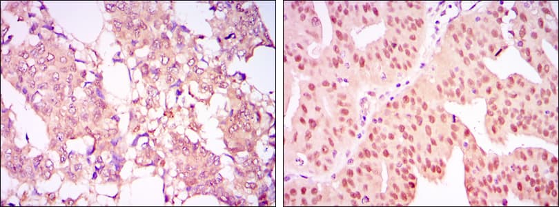 PRMT4 / CARM1 Antibody (clone 3H2)