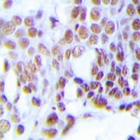 MGMT Antibody (N-Terminus)