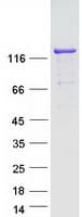 Human SRGAP1 Protein (Recombinant Myc-DDK (Flag))