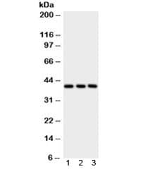 Polyclonal Rabbit anti-Human PTGER2 / EP2 Antibody (WB)
