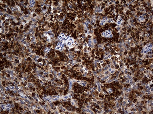 CRLF3 Antibody (clone OTI2H3)