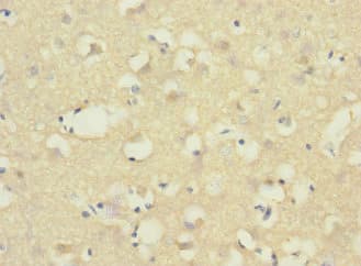 ADGRB1 / BAI1 Antibody (aa60-350)