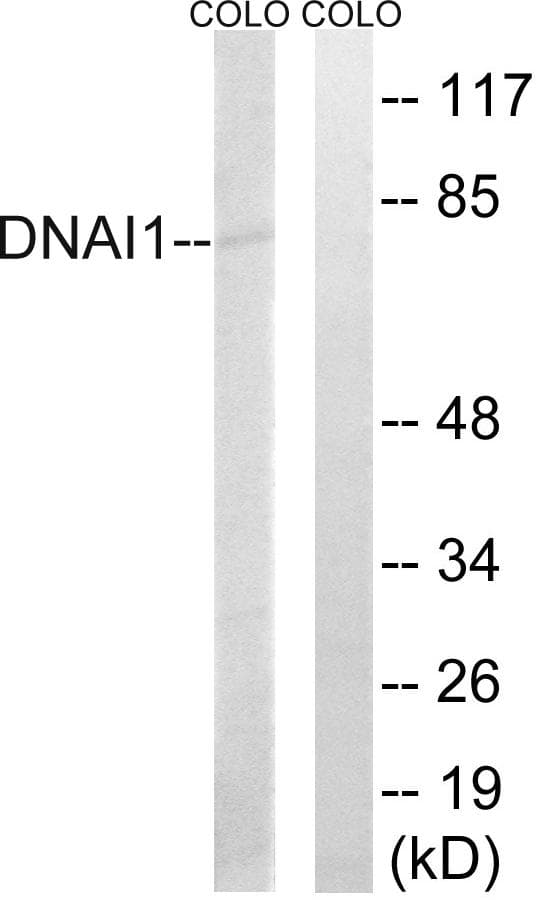 Polyclonal Rabbit anti-Human DNAI1 Antibody (WB)