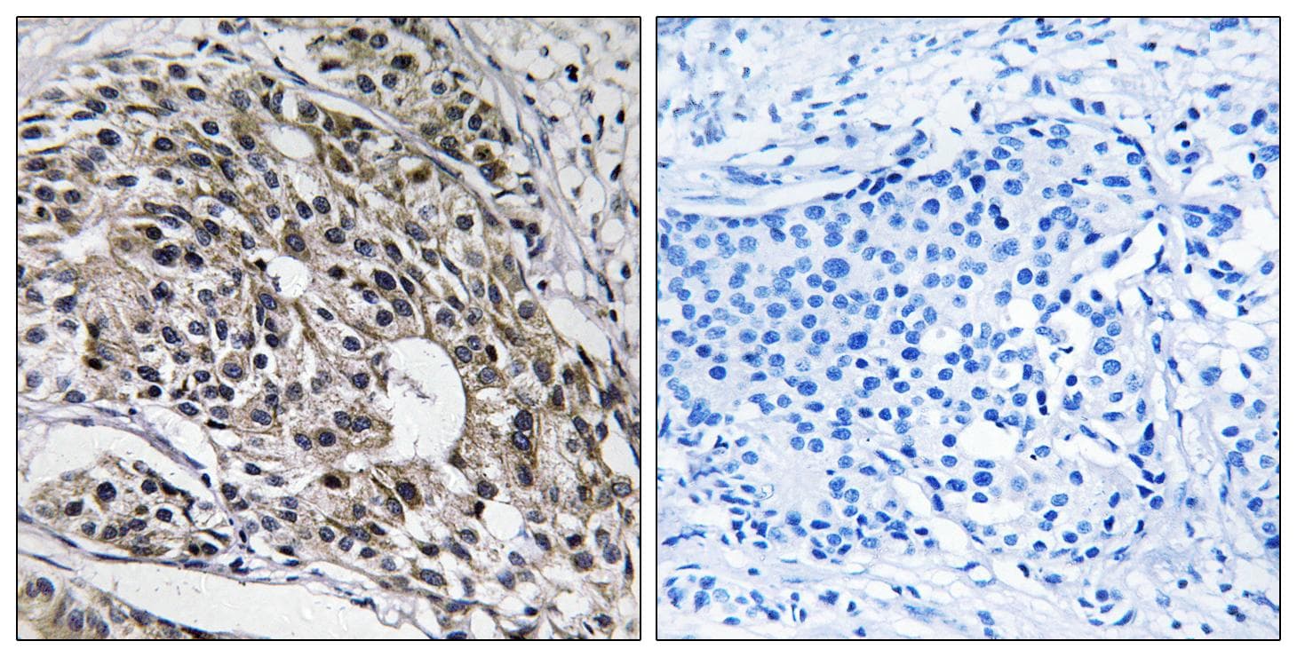 Polyclonal Rabbit anti-Human MRPL13 Antibody (IHC, WB)
