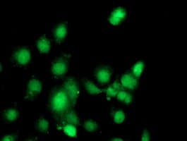 Complement C1s Antibody (clone OTI5F2)