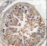 PRKAG1 / AMPK Gamma 1 Antibody (aa265-295)