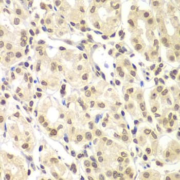 ULK4 Antibody