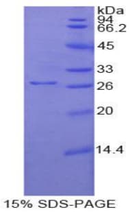 Mouse UCHL1 / PGP9.5 Protein (Recombinant His)