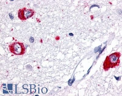 PathPlus™ GPR83 Antibody (Extracellular Domain)