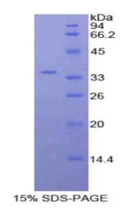 Human MYO1F Protein (Recombinant His)