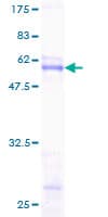 Human SCNM1 Protein (Recombinant GST)