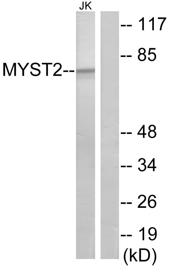 Polyclonal Rabbit anti-Human MYST2 / HBO1 Antibody (aa131-180, IF, WB)
