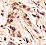 RB1 / Retinoblastoma / RB Antibody (phospho-Ser608)