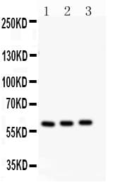 P450SCC / CYP11A1 Antibody (aa53-66)