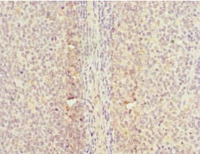 CDC7 Antibody