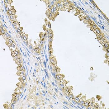 HSP90AA1 / Hsp90 Alpha A1 Antibody