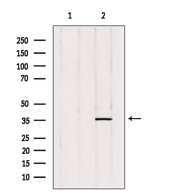 PTGR2 / PGR2 Antibody