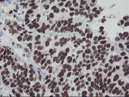 MEIS3 Antibody (aa1-261, clone OTI3E12, Carrier-free)