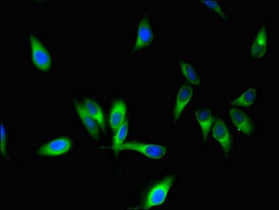 STMN1 / Stathmin / LAG Antibody