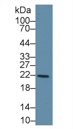 GSTK1 Antibody (aa7-222)