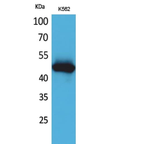 IL5RA / CD125 Antibody (N-Terminal)