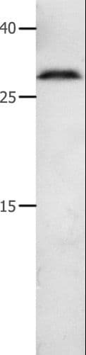 MMP7 / Matrilysin Antibody