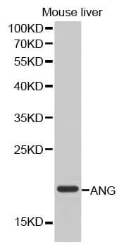 IHC-plus™ Angiogenin / ANG Antibody