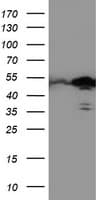 Monoclonal Mouse anti-Human TAL1 Antibody (clone OTI5B12, IF, WB)