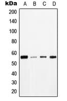 Polyclonal Rabbit anti-Human MAPT / Tau Antibody (phospho-Thr534, WB)