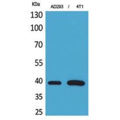 Polyclonal Rabbit anti-Human TNNT2 / CTNT Antibody (131-180 aa, Internal, IHC, WB)